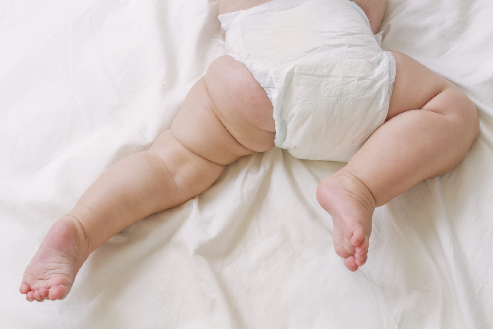 сыпь от памперсов