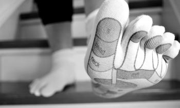 Вальгусная деформация первого пальца стопы («косточки» или «шишки» на ногах)